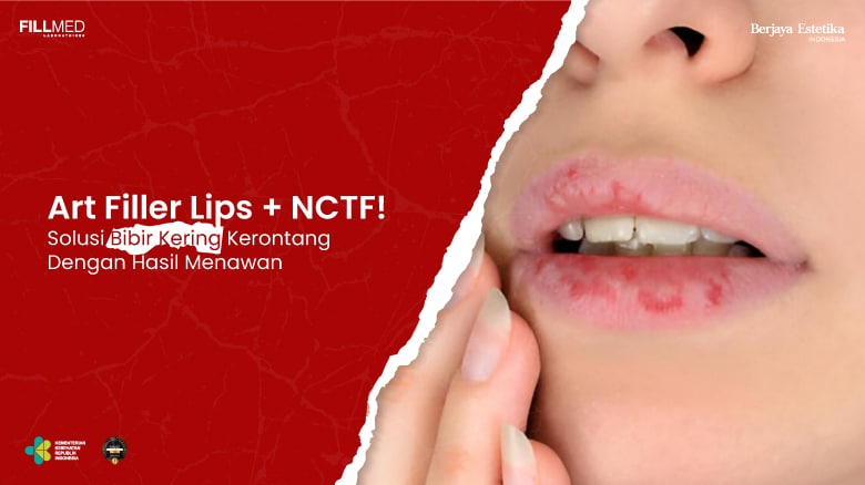 Filler bibir natural